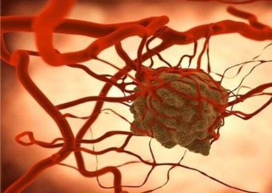 刺果番荔枝功效与作用,能延缓衰老治便秘还消除寄生虫